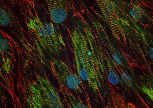 iPSC Disease Modelling Platf